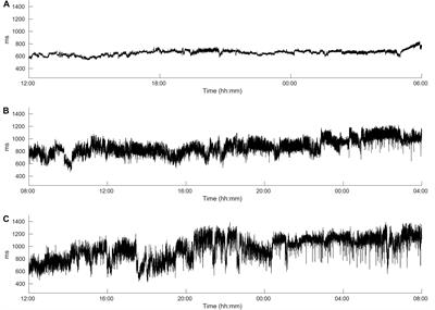 Cardiac Autonomic Dysfunction and Incidence of de novo Atrial Fibrillation: Heart Rate Variability vs. Heart Rate Complexity